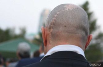 у перенесших коронавирус выпадают волосы